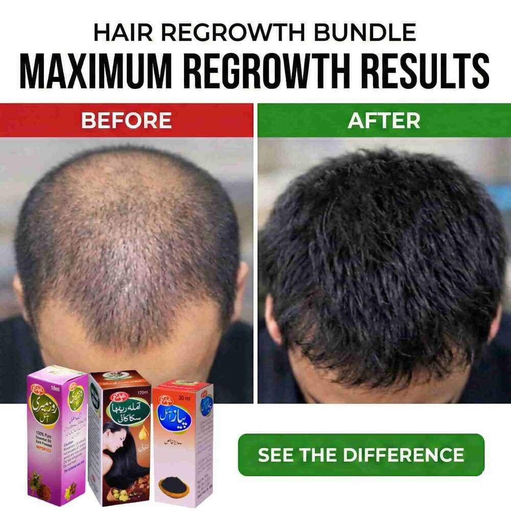 Hair Regrowth Bundle (Onion+Rosemary+Amla Retha Sikakai) oil