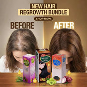 Hair Regrowth Bundle (Onion+Rosemary+Amla Retha Sikakai) oil