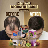 Hair Regrowth Bundle (Onion+Rosemary+Amla Retha Sikakai) oil