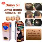 Hair-Regrowth Bundle (Onion+Amla, Retha, Sikakai) - Image 5