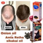 Hair-Regrowth Bundle (Onion+Amla, Retha, Sikakai) - Image 4