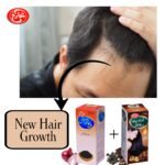 Hair-Regrowth Bundle (Onion+Amla, Retha, Sikakai) - Image 7