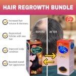 Hair-Regrowth Bundle (Onion+Amla, Retha, Sikakai) - Image 3